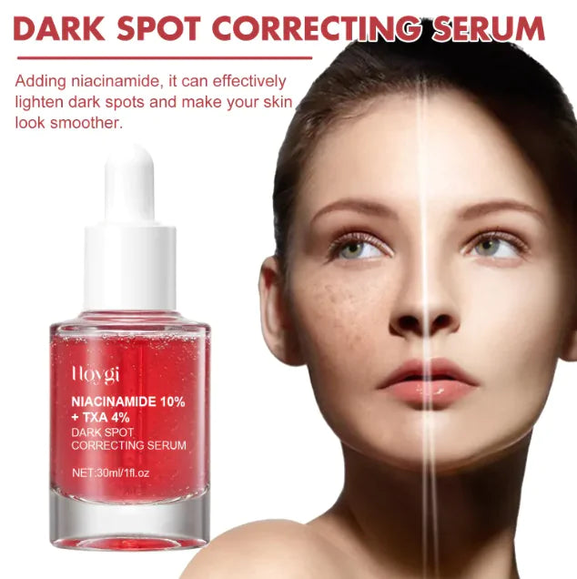 Hogyi Niacinamide 10% + TXA 4% – Dark Spot Correcting Serum