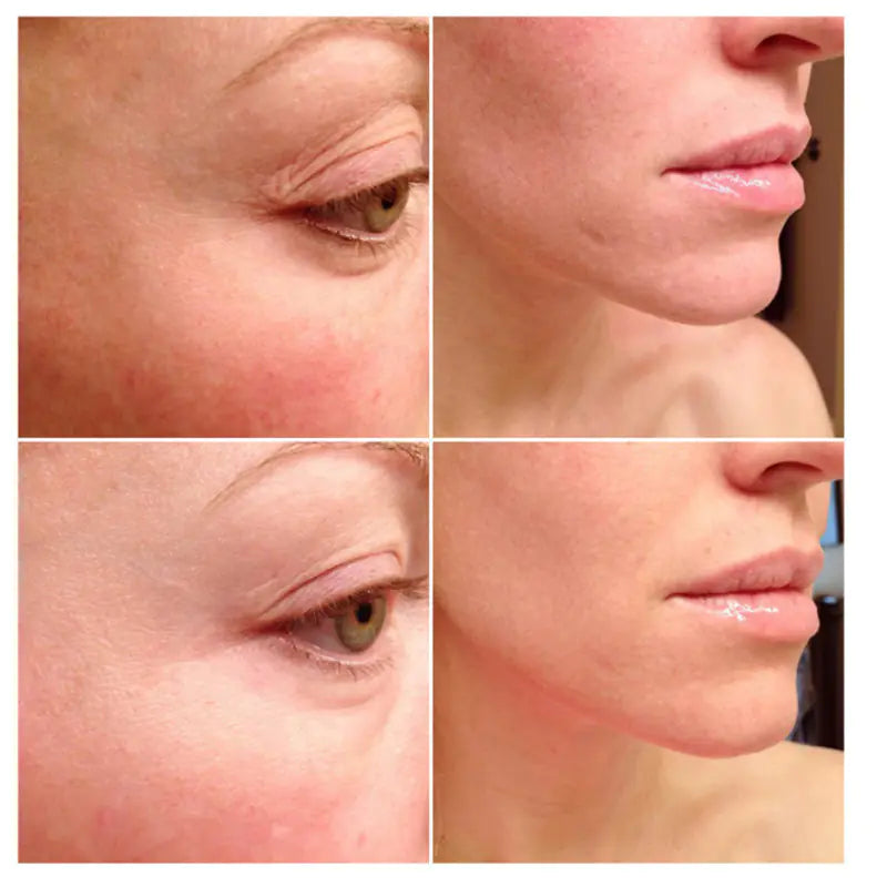 The Ordinary Multi-Peptide Anti-Aging Serum – Firm, Plump & Rejuvenate