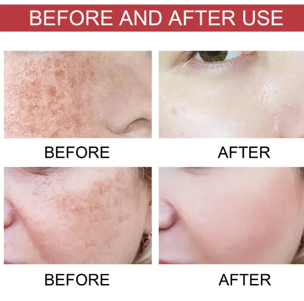 Hogyi Niacinamide 10% + TXA 4% – Dark Spot Correcting Serum