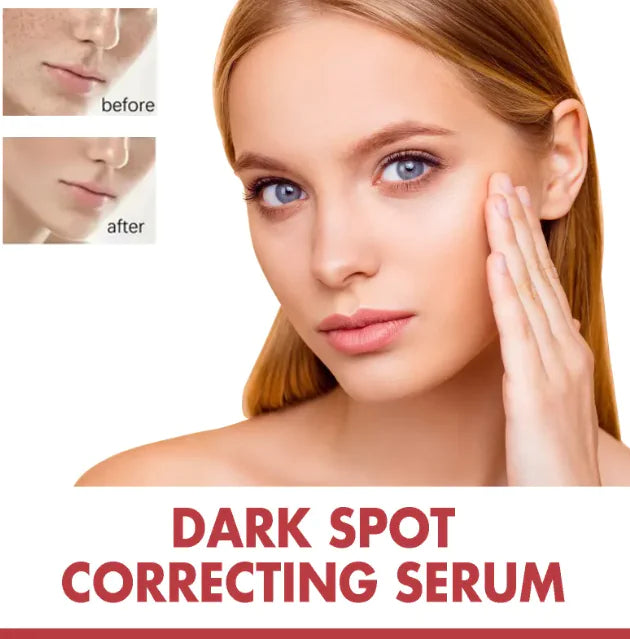 Hogyi Niacinamide 10% + TXA 4% – Dark Spot Correcting Serum